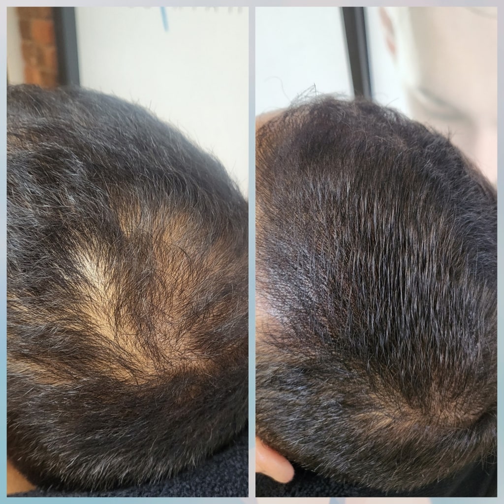 Men SMP Density 1-min