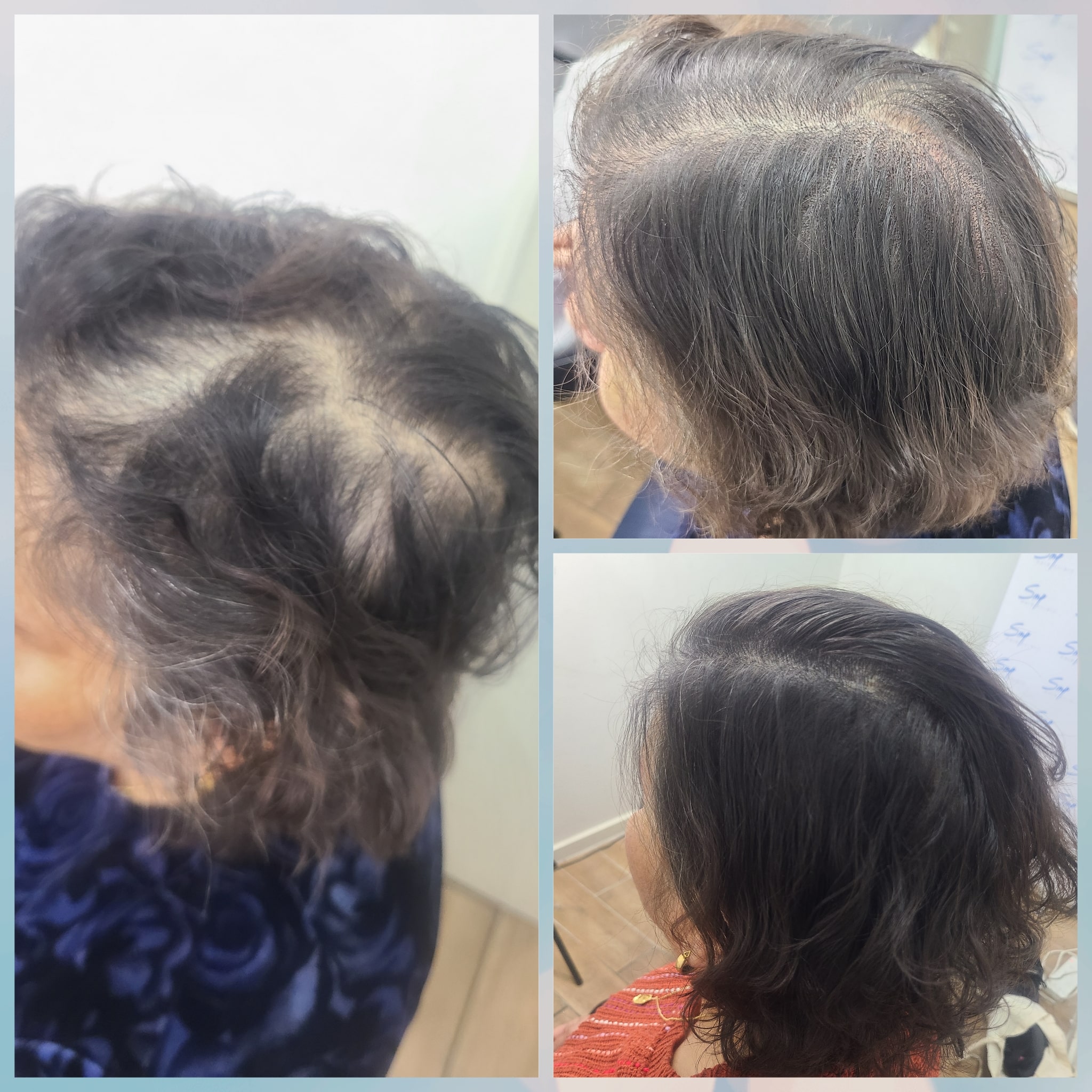 Women Density SMP 10-min