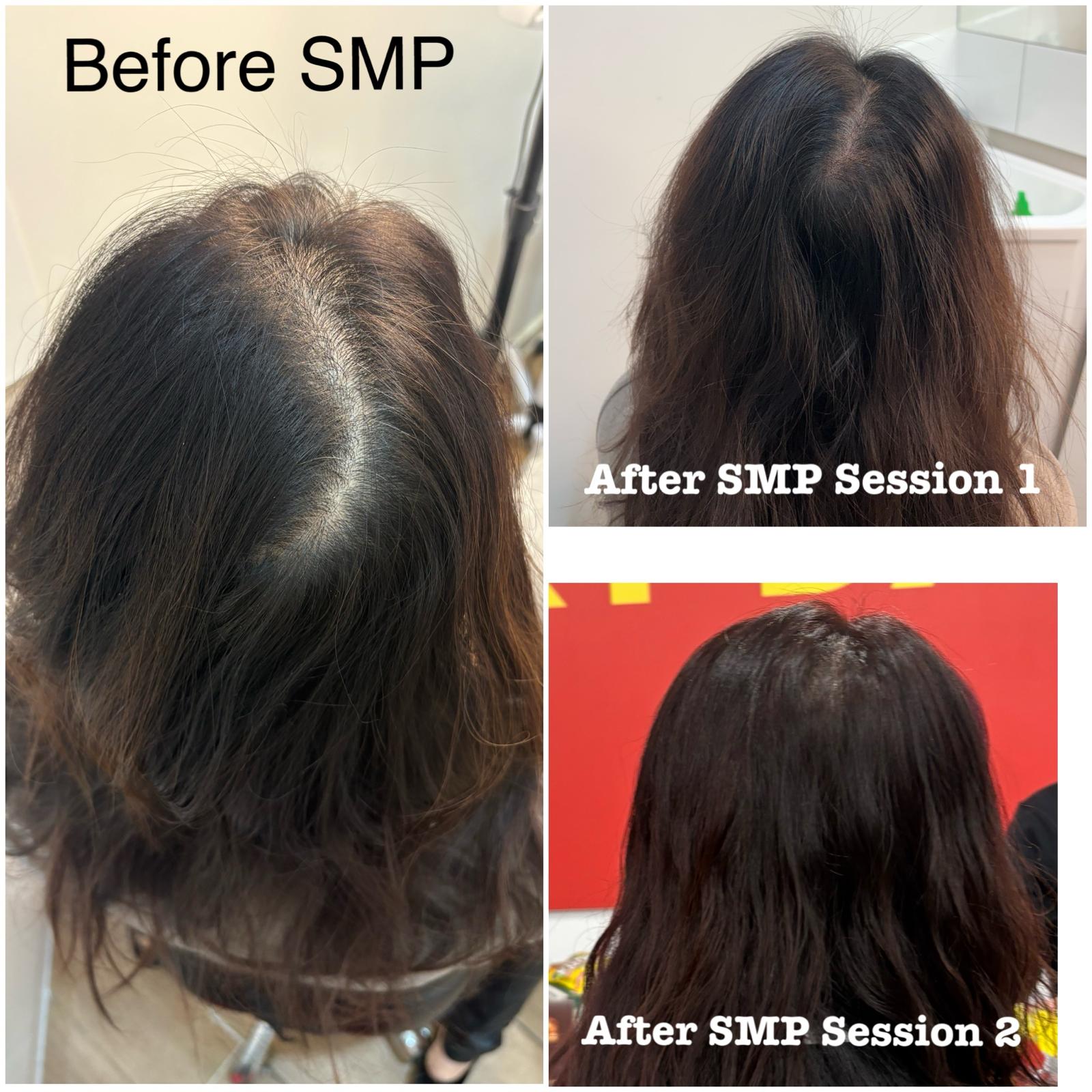 Women Density SMP 5-min