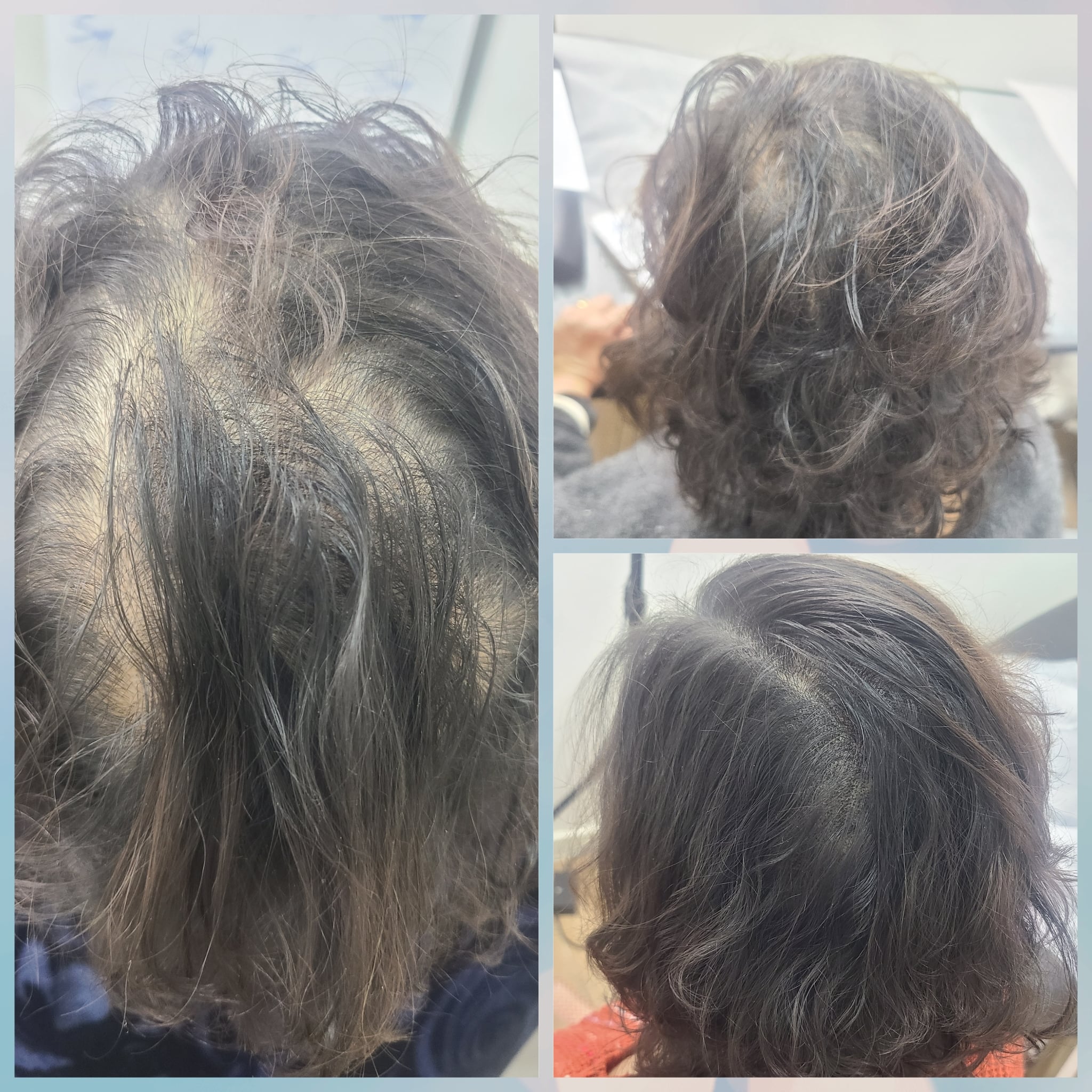 Women Density SMP 8-min